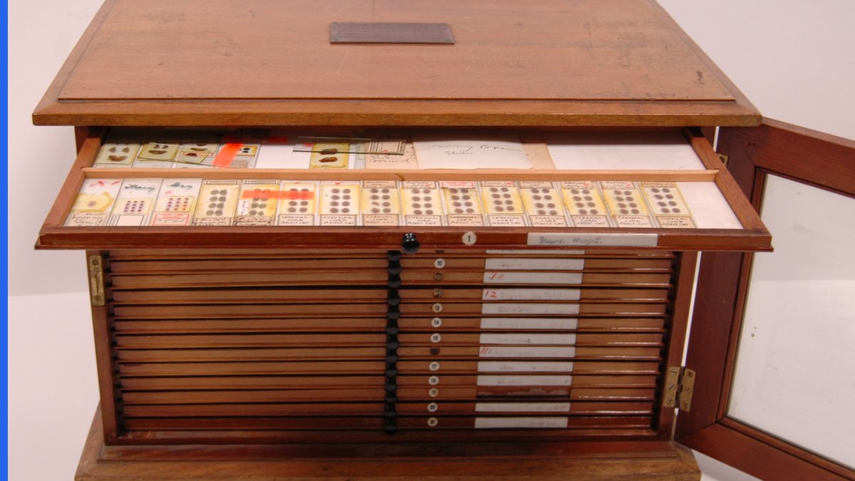 Histology slide of the kind filed as a patent photograph