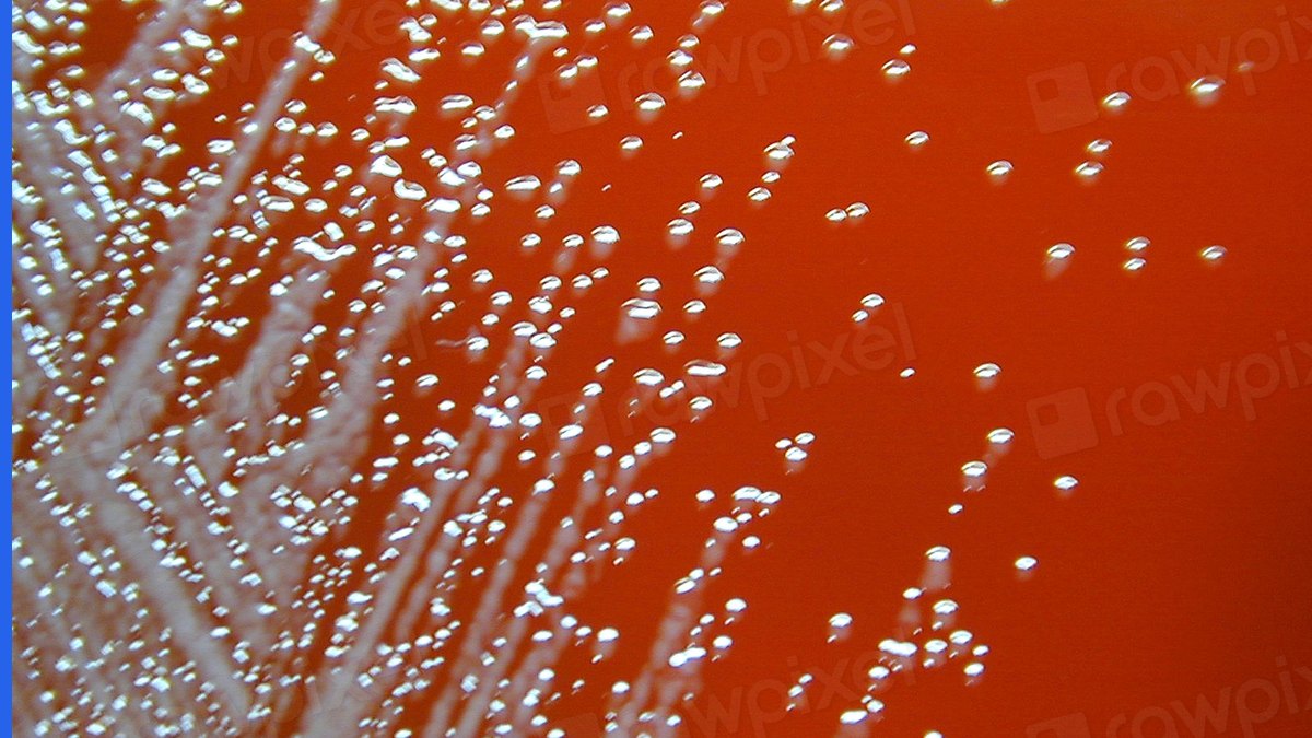 Photographs in patent applications: stained tissue sample under a microscope